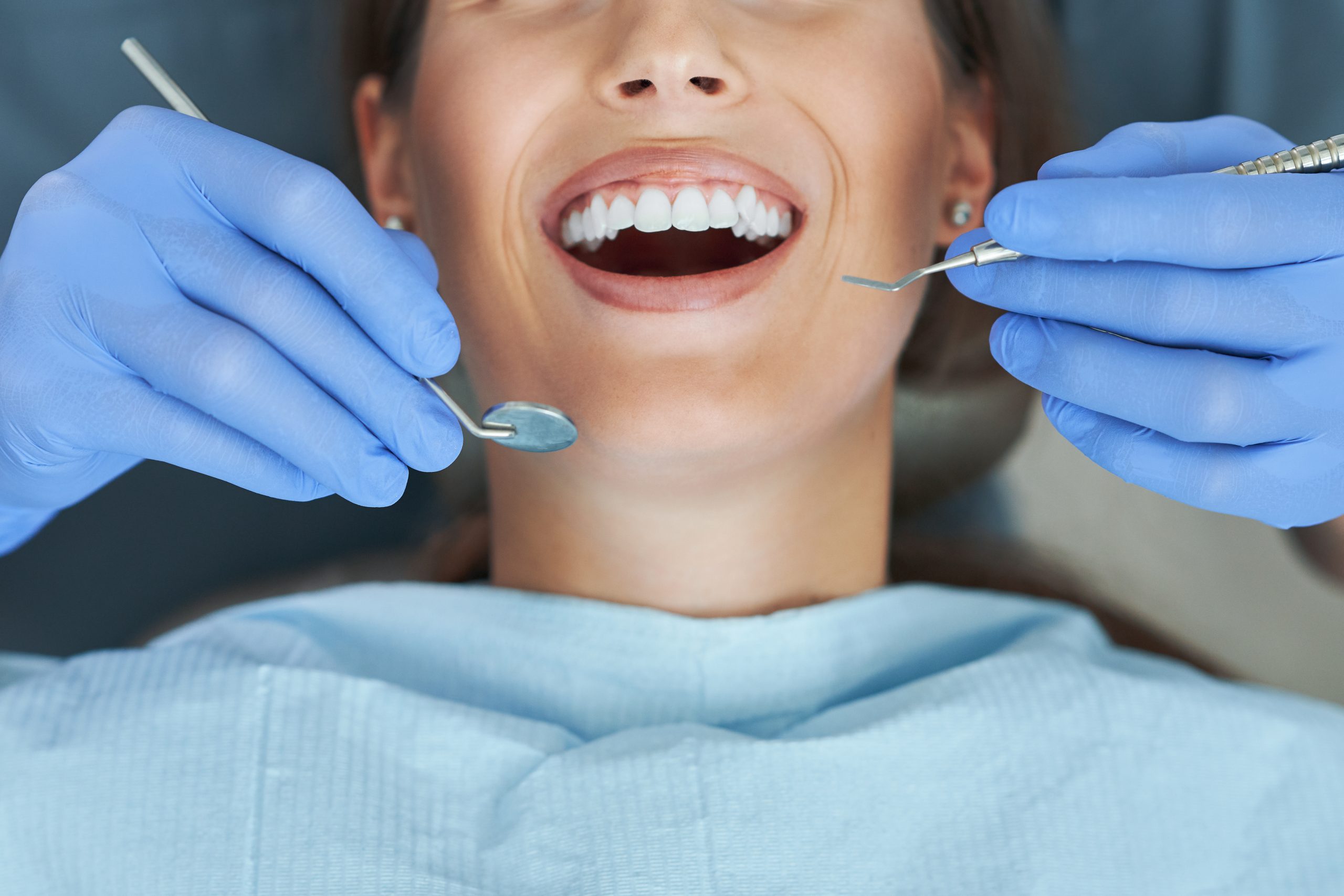 Best Dental Imperfections To Cover With Dental Bonding
