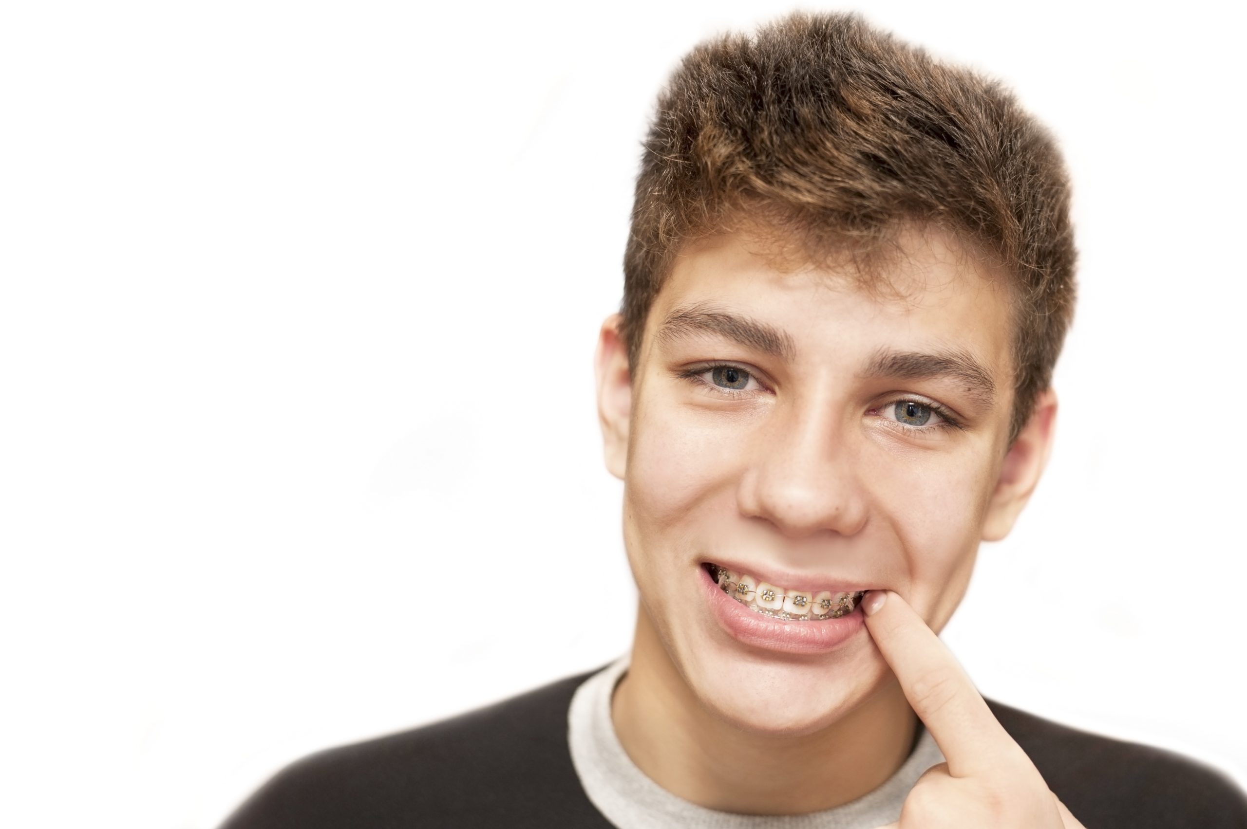 How Teeth Show Signs Of Stress