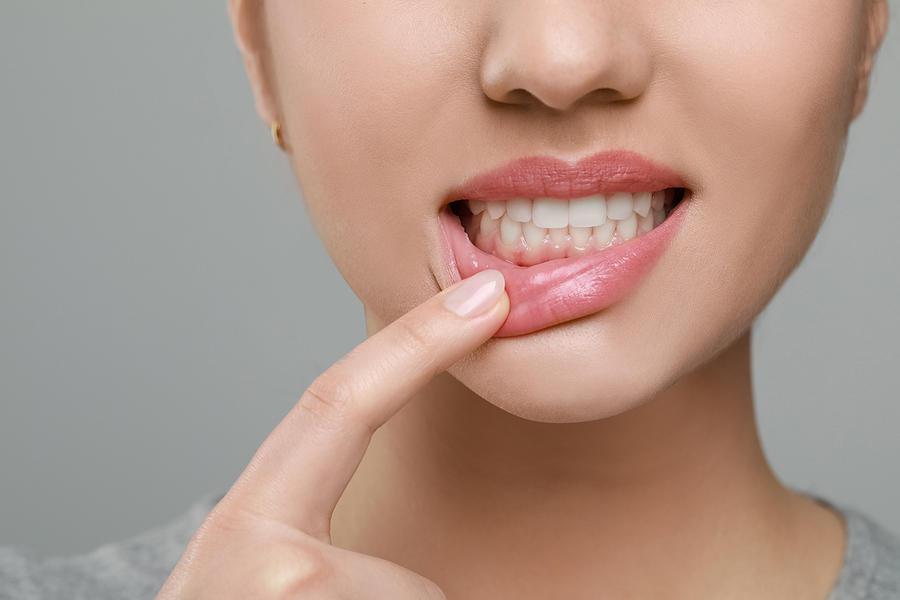 What Are the Causes of Gum Disease?
