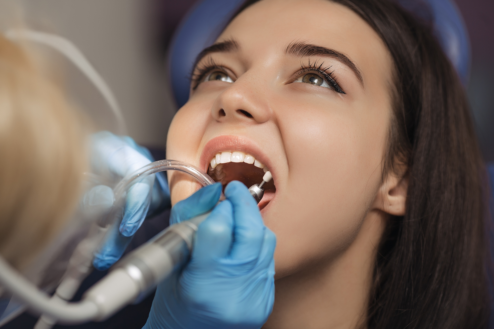 What to Expect After a Tooth Extraction: A Step-by-Step Recovery Guide